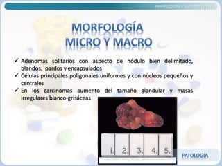 PARATIROIDES Y SUPRARRENALES
 Adenomas solitarios con aspecto de nódulo bien delimitado,
blandos, pardos y encapsulados
 Células principales poligonales uniformes y con núcleos pequeños y
centrales
 En los carcinomas aumento del tamaño glandular y masas
irregulares blanco-grisáceas
 