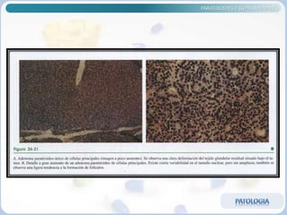 PARATIROIDES Y SUPRARRENALES
 