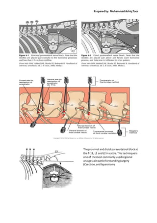Preparedby Muhammad AshiqToor
The proximal anddistal paravertebral blockat
the T-13, L1 andL2 in cattle.Thistechnique is
one of the mostcommonlyusedregional
analgesiaincattle forstandingsurgery
(Csection,and laparotomy
 