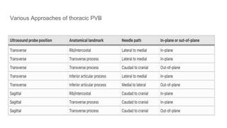 Various Approaches of thoracic PVB
 