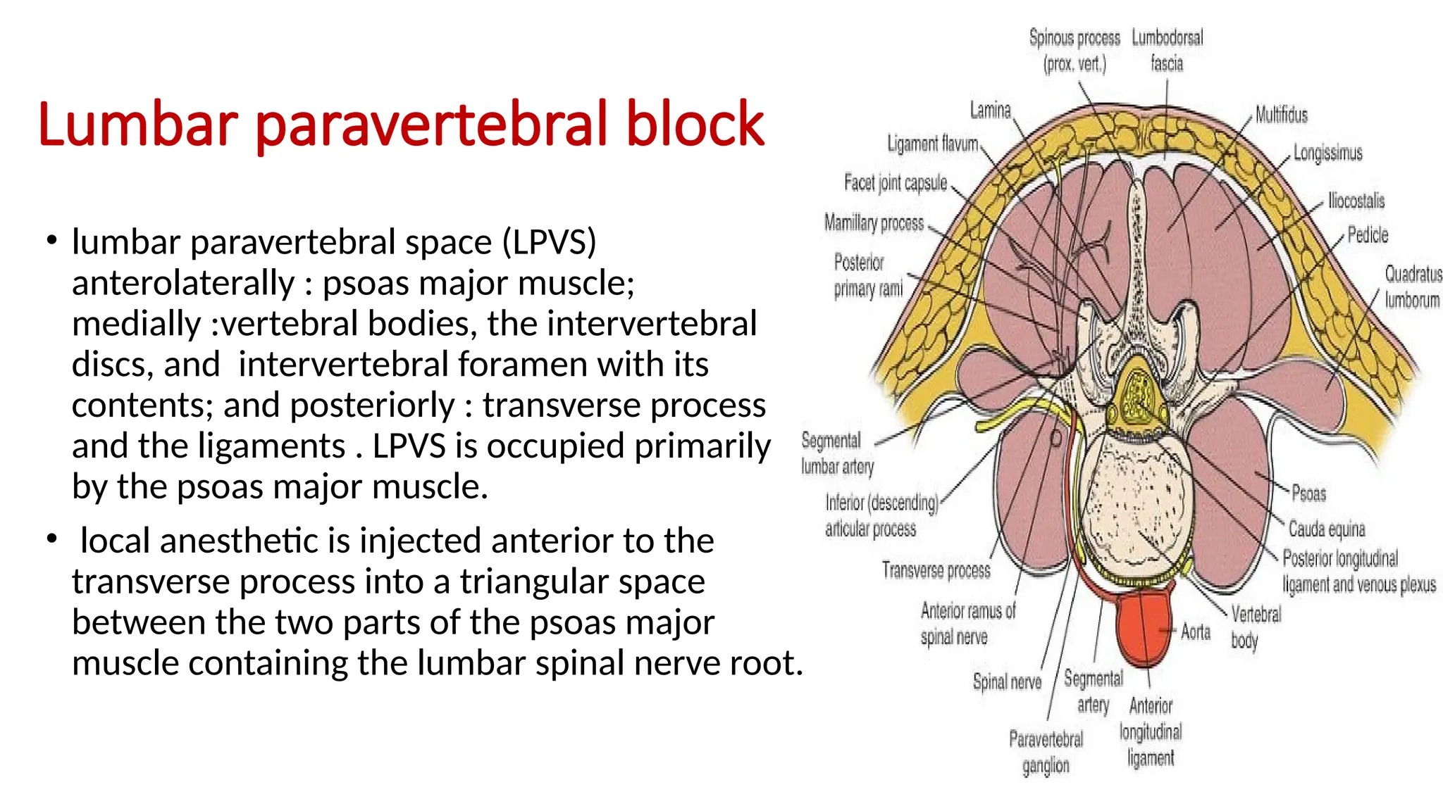 Lumbar paravertebral block
• lumbar paravertebral space (LPVS)
anterolaterally : psoas major muscle;
medially :vertebral bodies, the intervertebral
discs, and intervertebral foramen with its
contents; and posteriorly : transverse process
and the ligaments . LPVS is occupied primarily
by the psoas major muscle.
• local anesthetic is injected anterior to the
transverse process into a triangular space
between the two parts of the psoas major
muscle containing the lumbar spinal nerve root.
 