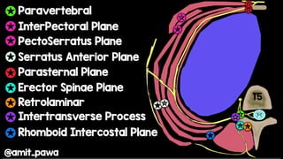 Paravertebral Block