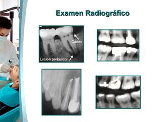Examen Radiográfico 