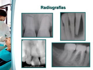 Radiografías 