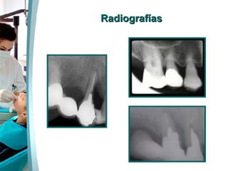 Radiografías 
