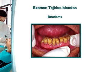 Examen Tejidos blandos Bruxismo 