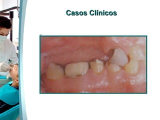 Casos Clínicos 