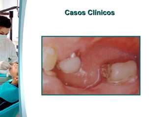Casos Clínicos 