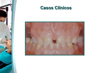 Casos Clínicos 