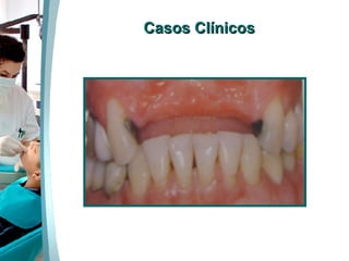 Casos Clínicos 