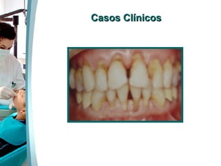 Casos Clínicos 