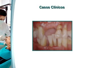 Casos Clínicos 