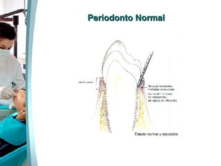Periodonto Normal 