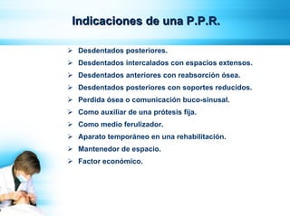 Parcial Removible 3