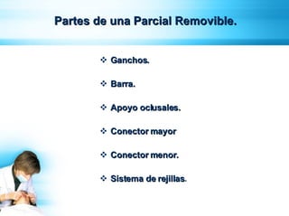 Parcial Removible 3