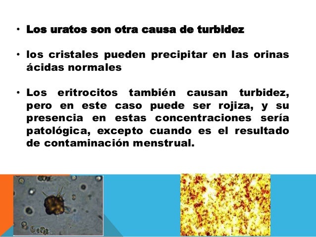 Parcial de orina