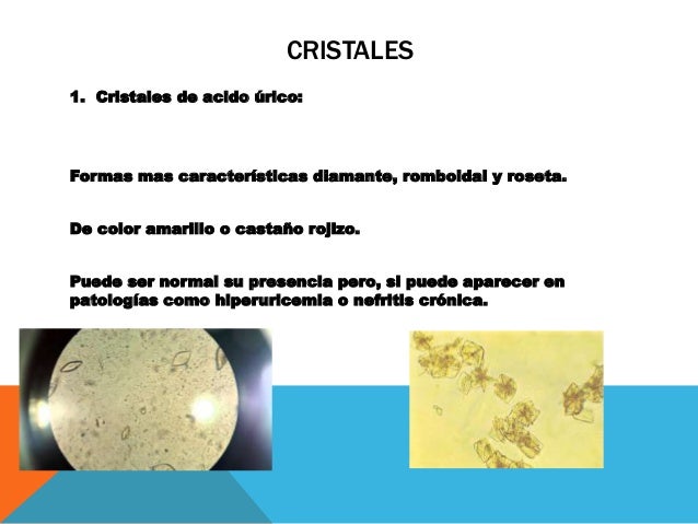 Parcial de orina