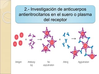 2.- Investigación de anticuerpos
antieritrocitarios en el suero o plasma
del receptor
 