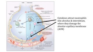 Pediatric Acute Respiratory Distress Syndrome.pptx