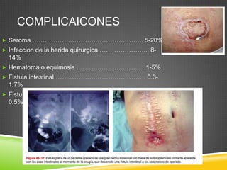 COMPLICAICONES
 Seroma …………………………………………….. 5-20%
 Infeccion de la herida quirurgica …………………... 8-
14%
 Hematoma o equimosis ……………………………1-5%
 Fistula intestinal ……………………………………. 0.3-
1.7%
 Fistulizacion de la malla a traves de la piel …………
0.5%
 