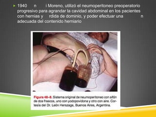  1940 n i Moreno, utilizó el neumoperitoneo preoperatorio
progresivo para agrandar la cavidad abdominal en los pacientes
con hernias y rdida de dominio, y poder efectuar una n
adecuada del contenido herniario
 
