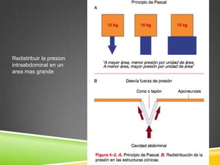 Redistribuir la presion
intraabdominal en un
area mas grande
 
