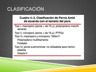 CLASIFICACIÓN
 