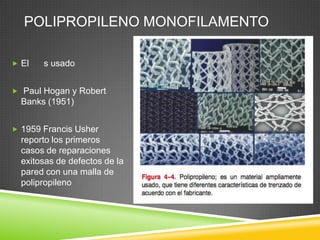 POLIPROPILENO MONOFILAMENTO
 El s usado
 Paul Hogan y Robert
Banks (1951)
 1959 Francis Usher
reporto los primeros
casos de reparaciones
exitosas de defectos de la
pared con una malla de
polipropileno
 