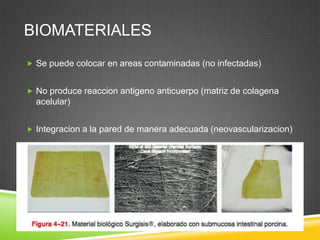 BIOMATERIALES
 Se puede colocar en areas contaminadas (no infectadas)
 No produce reaccion antigeno anticuerpo (matriz de colagena
acelular)
 Integracion a la pared de manera adecuada (neovascularizacion)
 