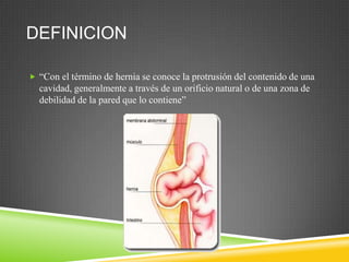 DEFINICION
 “Con el término de hernia se conoce la protrusión del contenido de una
cavidad, generalmente a través de un orificio natural o de una zona de
debilidad de la pared que lo contiene”
 