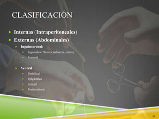 CLASIFICACIÓN
 Internas (Intraperitoneales)
 Externas (Abdominales)
 Inguinocrural:
 Inguinales (Directa, indirecta, mixta)
 Femoral
 Ventral
 Umbilical
 Epigástrica
 Spiegel
 Postincisional
39
 