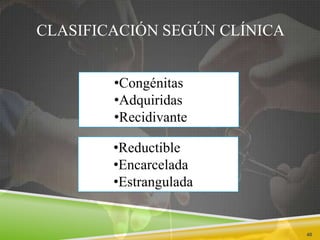 CLASIFICACIÓN SEGÚN CLÍNICA
40
•Reductible
•Encarcelada
•Estrangulada
•Congénitas
•Adquiridas
•Recidivante
 