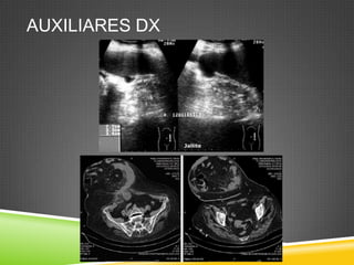 AUXILIARES DX
 
