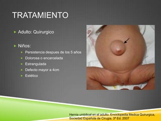 TRATAMIENTO
 Adulto: Quirurgico
 Niños:
 Persistencia despues de los 5 años
 Dolorosa o encarcelada
 Estrangulada
 Defecto mayor a 4cm
 Estético
Hernia umbilical en el adulto. Enciclopedia Medica Quirurgica,
Sociedad Española de Cirugia. 3ª Ed. 2007
 