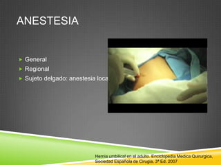ANESTESIA
 General
 Regional
 Sujeto delgado: anestesia local
Hernia umbilical en el adulto. Enciclopedia Medica Quirurgica,
Sociedad Española de Cirugia. 3ª Ed. 2007
 