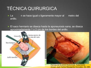 TÉCNICA QUIRURGICA
 La n se hace igual o ligeramente mayor al metro del
anillo.
 El saco herniario se diseca hasta la aponeurosis sana, se diseca
aproximadamente 1 o 2 cm de los bordes del anillo.
Hernias de la pared Abdominal, Tratamiento
Actual. Juan Carlos Mayagoitia Gonzalez. Ed. Alfil.
 