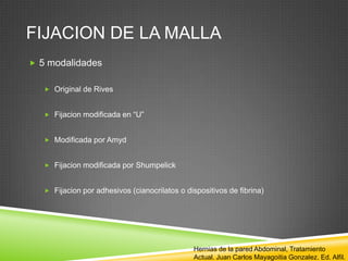 FIJACION DE LA MALLA
 5 modalidades
 Original de Rives
 Fijacion modificada en “U”
 Modificada por Amyd
 Fijacion modificada por Shumpelick
 Fijacion por adhesivos (cianocrilatos o dispositivos de fibrina)
Hernias de la pared Abdominal, Tratamiento
Actual. Juan Carlos Mayagoitia Gonzalez. Ed. Alfil.
 