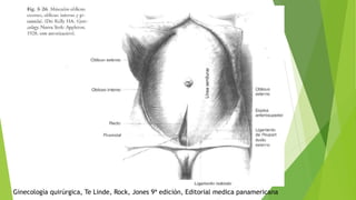 Ginecología quirúrgica, Te Linde, Rock, Jones 9ª edición, Editorial medica panamericana
 