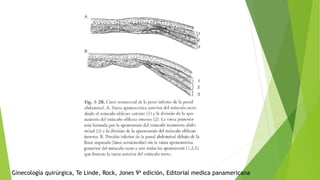 Ginecología quirúrgica, Te Linde, Rock, Jones 9ª edición, Editorial medica panamericana
 