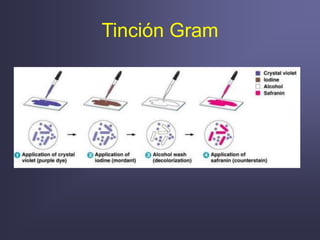 Tinción Gram