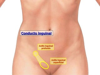 Conducto inguinal Anillo inguinal profundo Anillo inguinal superficial 