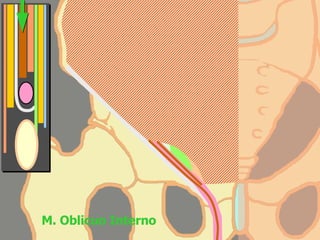 M. Oblicuo Interno 