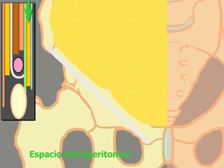 Espacio Extraperitoneal 