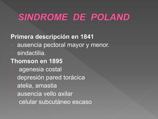 Primera descripción en 1841
• ausencia pectoral mayor y menor.
• sindactilia.
Thomson en 1895
• agenesia costal
• depresión pared torácica
• atelia, amastia
• ausencia vello axilar
• celular subcutáneo escaso
 