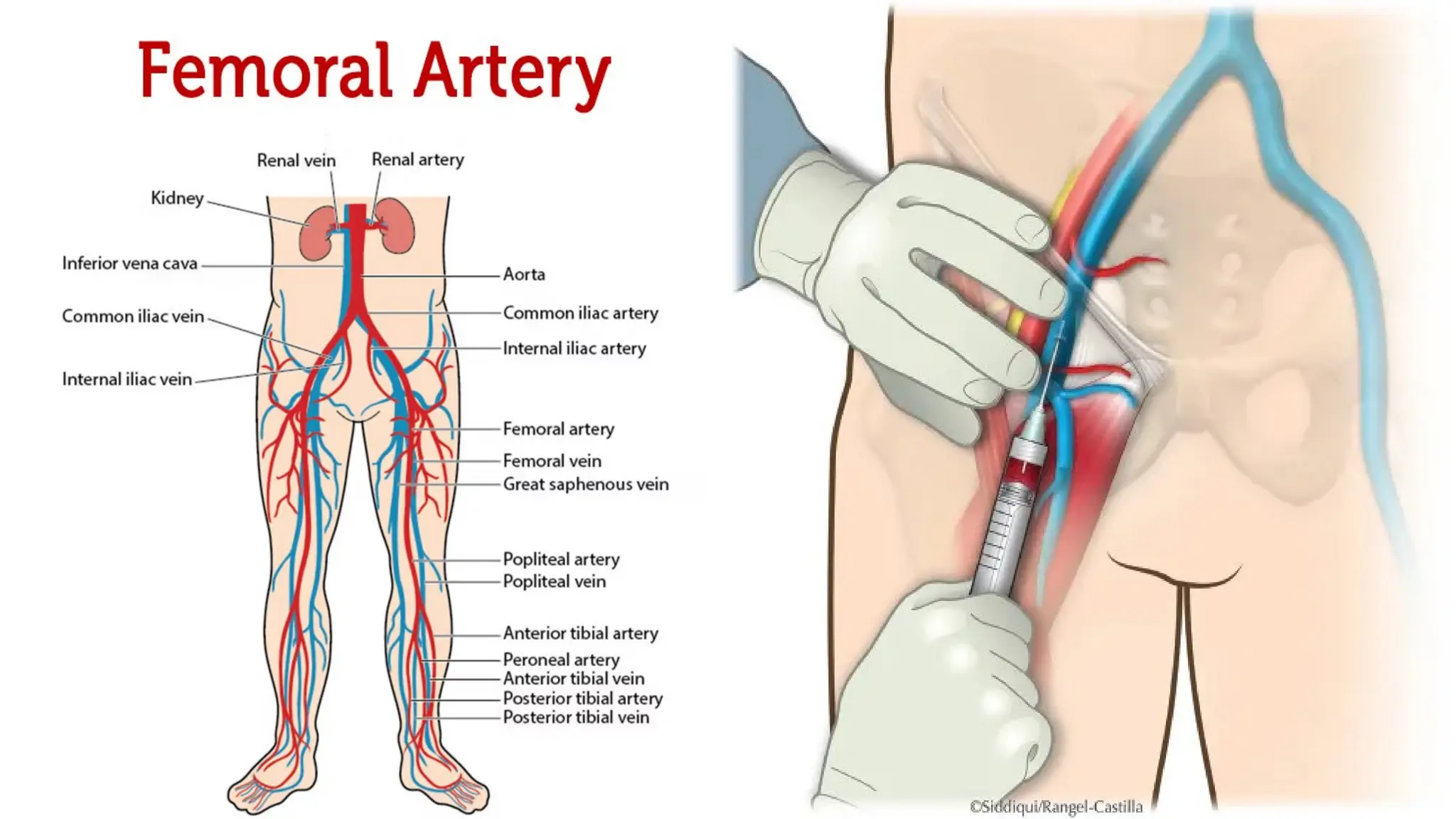 Parenteral Routes of Drug Administration: IM, IV, ID, and SC Injections ...