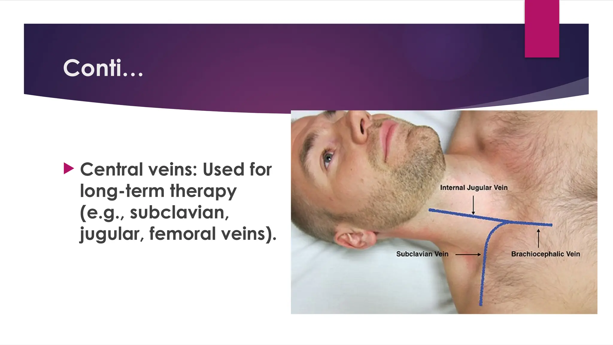 Parenteral Routes of Drug Administration: IM, IV, ID, and SC Injections ...