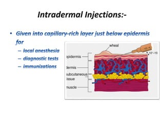 Intradermal Injections:-
 