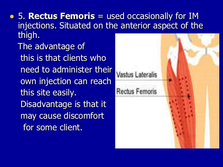 Parenteral Administration Chat Parenteral Administration Chat