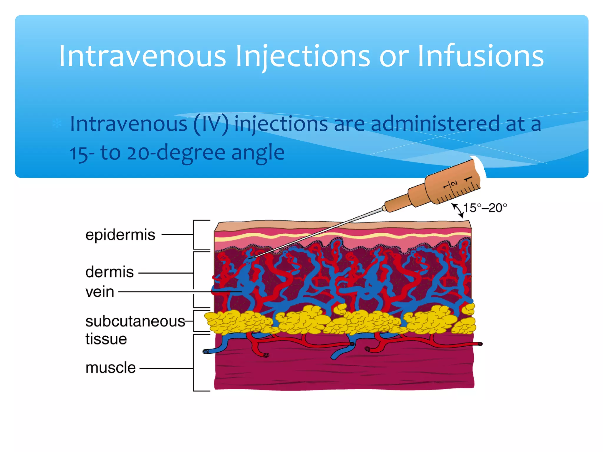Intravenous Injections or Infusions
∗ Intravenous (IV) injections are administered at a
15- to 20-degree angle

 