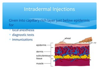 Distributed Capillary Injection Parenteral Administration | PPT
